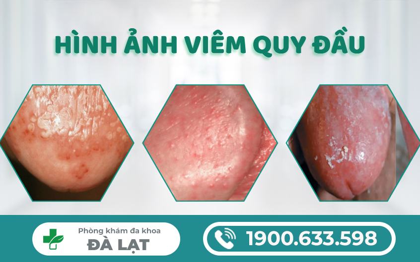 Hình ảnh minh họa